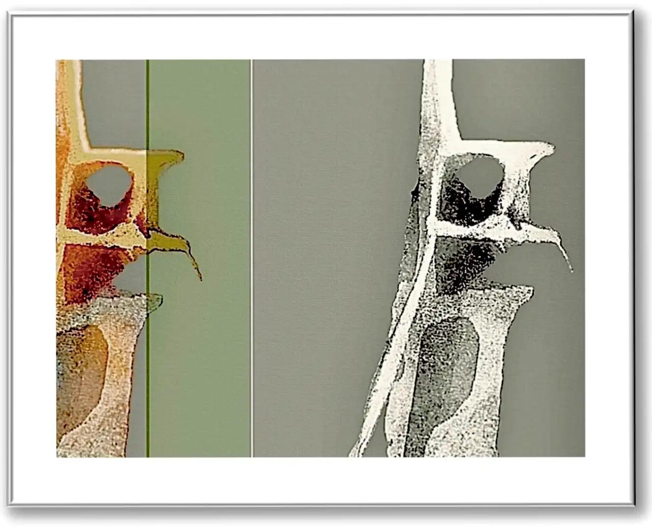 Sich vertikal wiederholende gelbliche und beige Elemente auf hellgrünem Grund, welche an die anatomische Struktur von Wirbelkörpern erinnern.